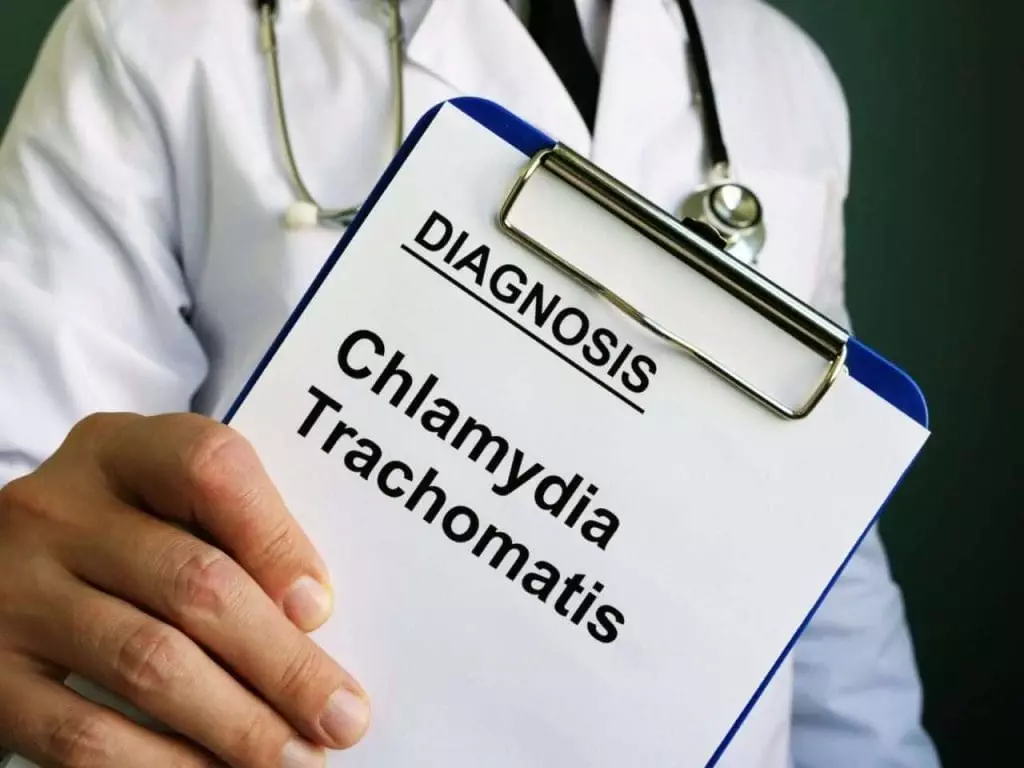 30288002 chlamydia trachomatis diagnosis in the hands of the doctor