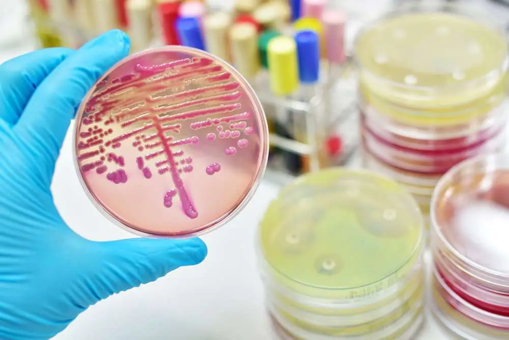 Best Guide to the 7 Early Common Yeast Infection Symptoms Yeast Infection Symptoms