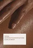 Hyperpigmentation: Causes And Treatments 5