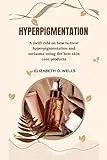 Hyperpigmentation: Causes And Treatments 1